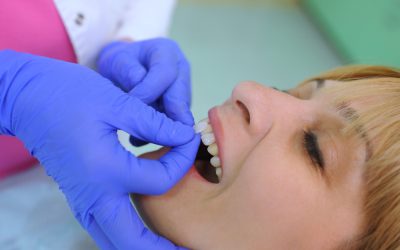 Dental Veneers: The Perfect Solution for a Perfect Smile