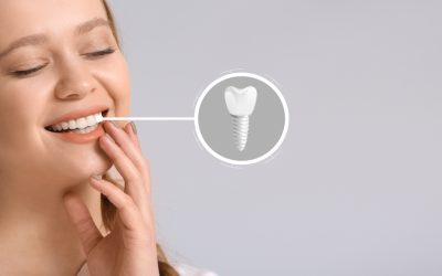 A Typical Dental Implant Procedure Explained